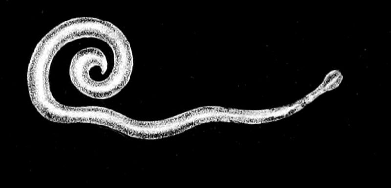 Parasitose intestinale (Oxyures)